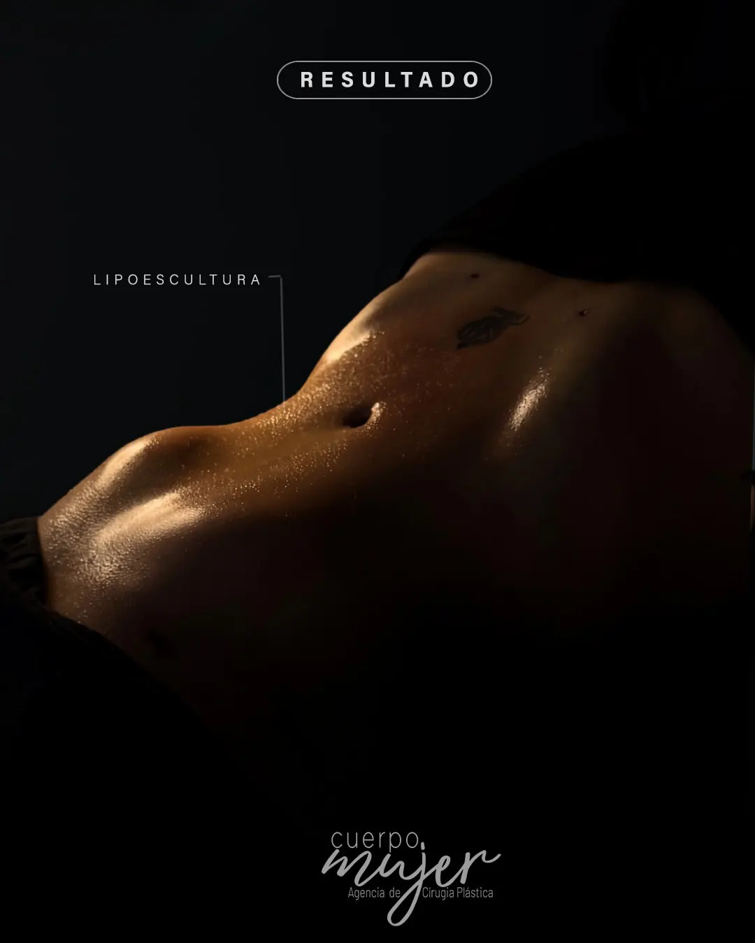 Lipoescultura (2)
