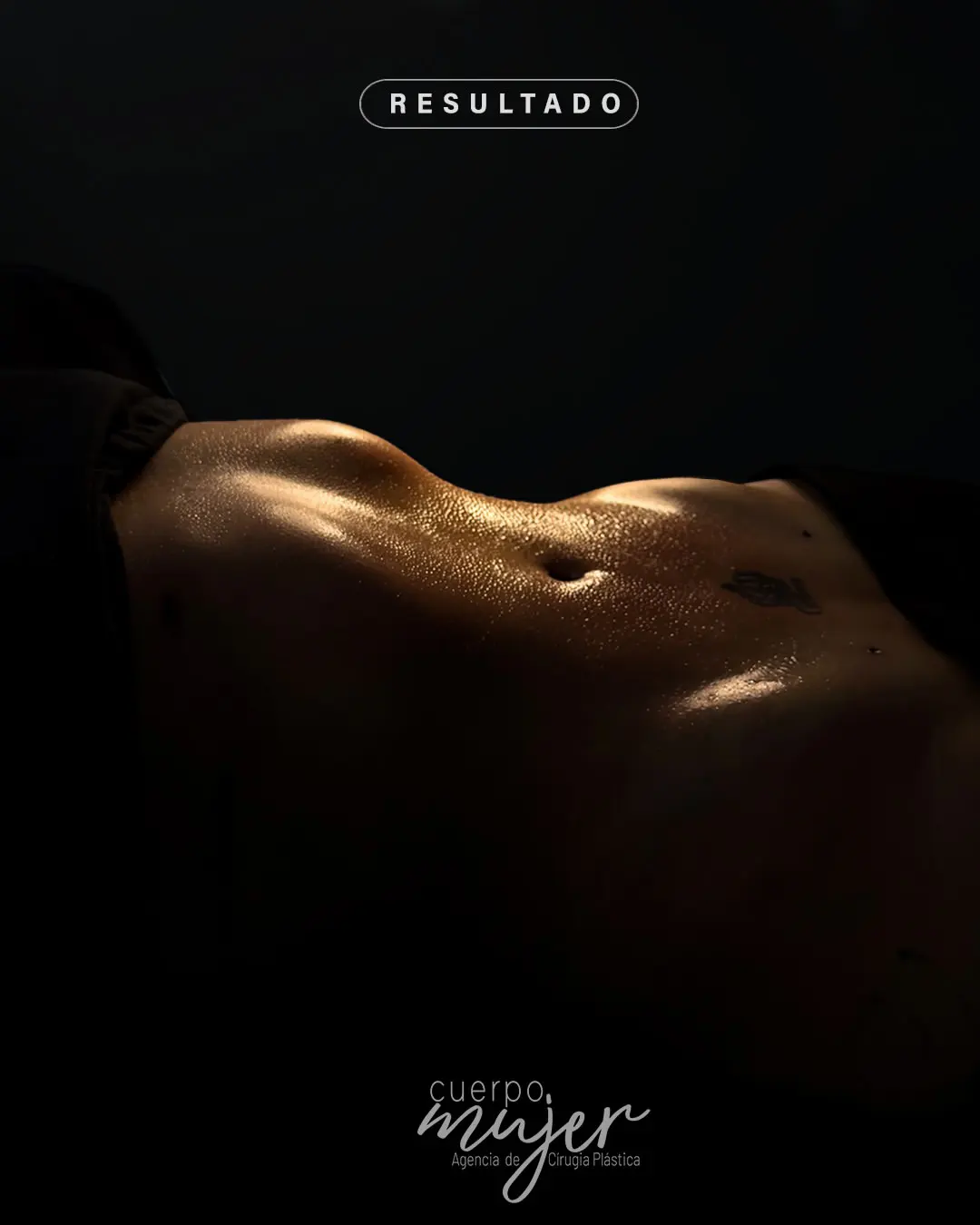 Resultado Lipoescultura Cuerpo Mujer 3